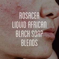 Fra Fra's Mini's Premium Healing Eczema Liquid Raw African Black Soap Blend 4 oz