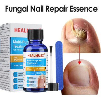 HEALMUSZ Antibacterial Fungal Nail Treatment Nail Repair Essential Oil Serum 30g