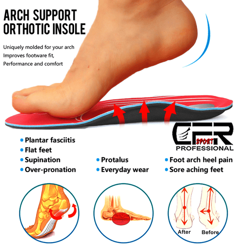 Orthotic Shoes Insoles Arch Support Inserts Pads Flat Feet Pain Unisex Women Men - Picture 3 of 14