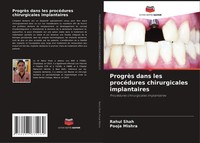 ProgrèS Dans Les ProcéDures Chirurgicales Implantaires Rahul Shah