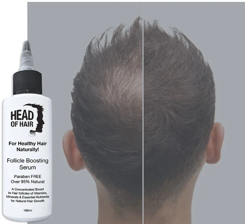 Hair growth follicle boosting serum - Head of Hair 100% Australia made and owned