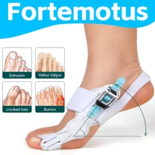 Bunion Fix Big Toe Valgus Corrector Adjustable Orthosis Foot Splints Fortemotus 