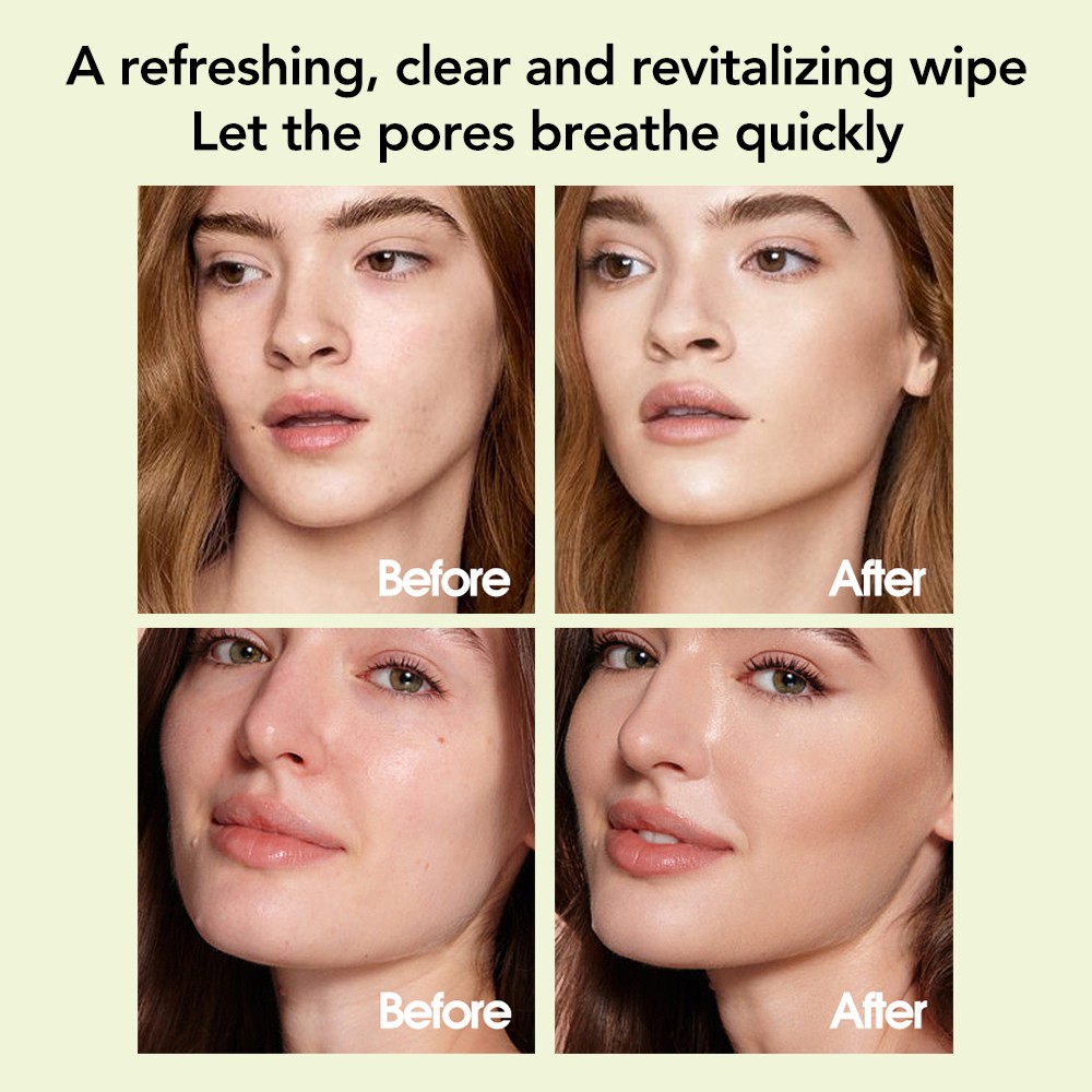 100Pcs Korean Skincare Toner Pads for Anti-Aging, Dark Spots&Wrinkles Cleaning