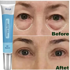 Rapid Reduction Eye Serum -Advanced Formula Anti Aging Wrinkles Eye Cream 15ml