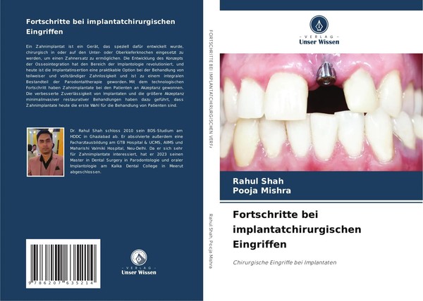 Rahul Shah (U. A.) | Fortschritte Bei Implantatchirurgischen Eingriffen | Buch-image