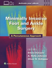 Minimally Invasive Foot and Ankle Surgery | A...