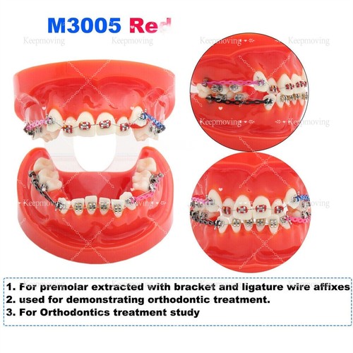 Modelo de dientes tipodonte dental ortoimplante patológico período práctica modelo de demostración - Imagen 15 de 41