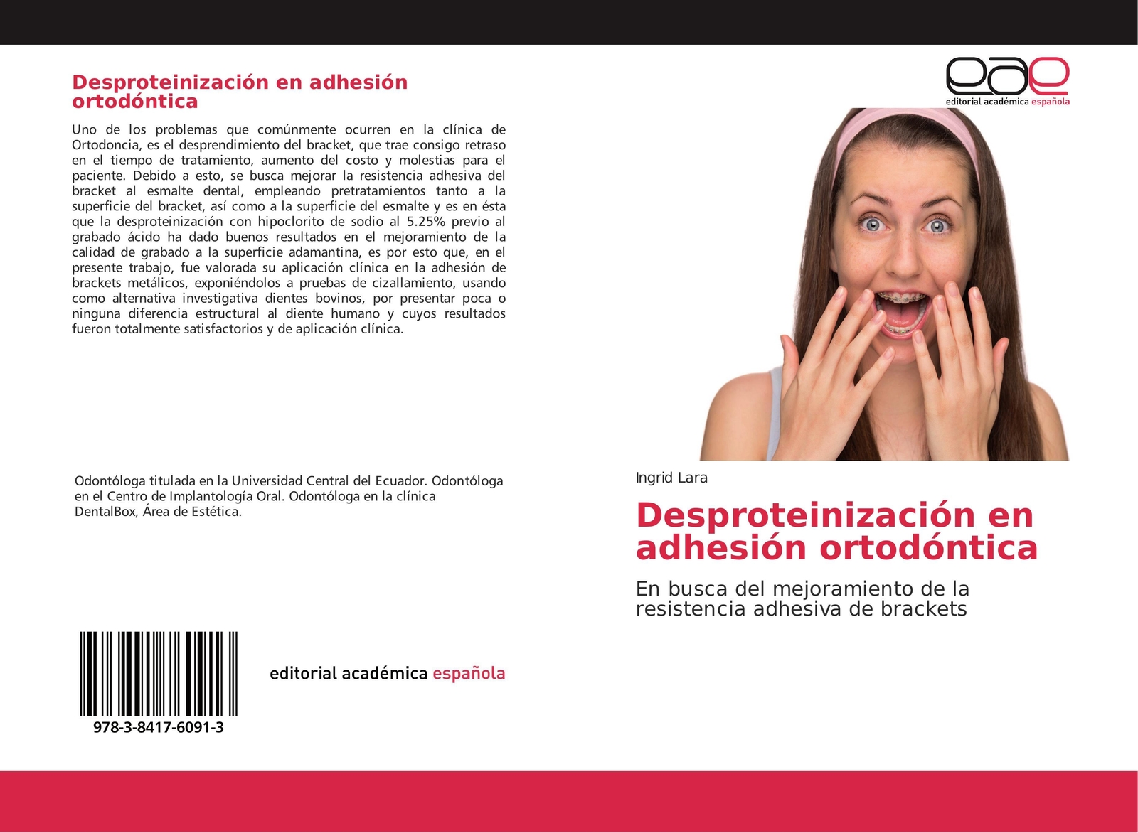 Thumbnail - Ingrid Lara | Desproteinización En Adhesión Ortodóntica | Taschenbuch