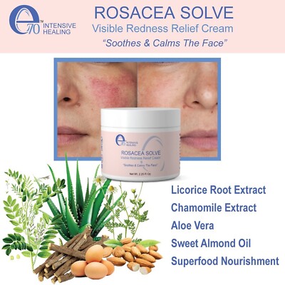 aloe vera special care Cape Aloe main image 1