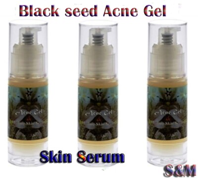 Amazing Acne Gel and Skin Serum 1 oz/30 ml made in NY USA SELLER!!!