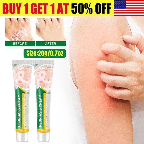 2x Eczema Psoriasis CREAM Ointment Inflammation Natural Anti Itching Dermatitis