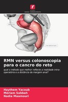 Rmn Versus Colonoscopia Para O Cancro Do Reto Haythem Yacoub