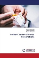 Saloni Vijaywargiya (U. A.) | Indirect Tooth-Colored Restorations | Taschenbuch