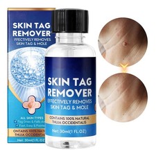 30ml Wart Remover Liquid Painlessly Skin Tag mole Remover
