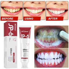 120g SIP-6 Probiotic Toothpaste, Whitening Sp-6 Probiotic Toothpaste Whitening