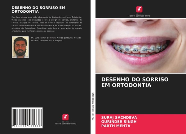 Suraj Sachdeva (U. A.) | Desenho DO Sorriso EM Ortodontia | Taschenbuch (2021)-image