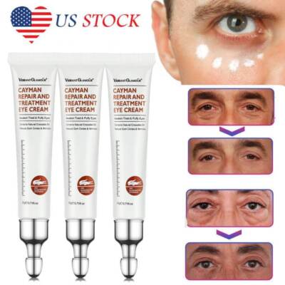3PCS Eye Cream Remove Eye Bags Dark Circles Anti Wrinkle Depuffing Firming