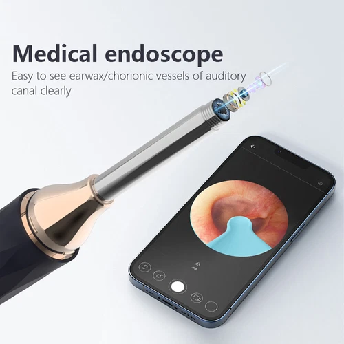 Smart Ear Wax Removal Pick LED Wireless Ear Camera Otoscope Visual Ear Cleaner - Bild 2 von 19