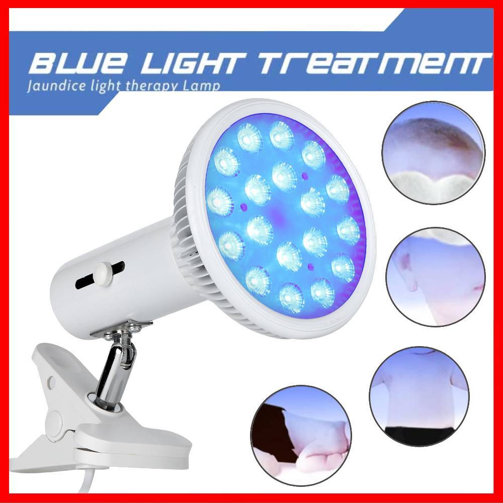 Types Of Phototherapy Lights For Jaundice Shelly Lighting