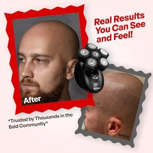 THE BALD EXPRESS ELECTRIC HEAD SHAVERS FOR BALD MEN - BALD BROTHERS - BLACK - Image 2 of 4