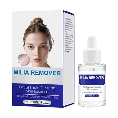 Milia Remover Treatment Spot Removal Serum Fat Granule Clearing Skin Essence