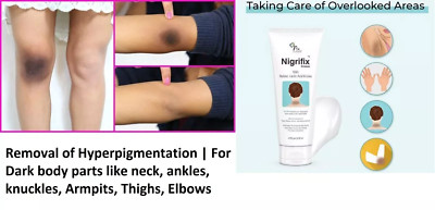 Fixderma Nigrifix Cream (50gm) Neck, Ankles, Knuckles, Armpits, Thighs & Elbows