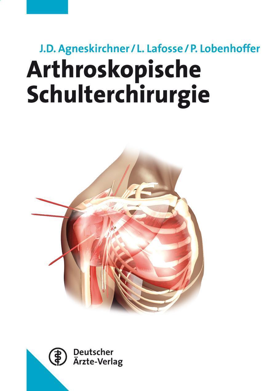 Thumbnail - Jens Agneskirchner (u. A.) | Arthroskopische Schulterchirurgie | Buch