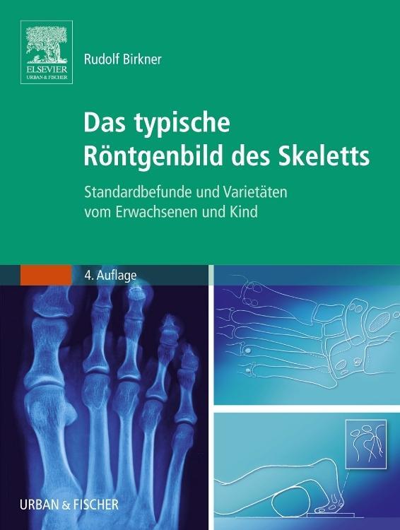 Thumbnail - Das Typische Röntgenbild Des Skeletts Rudolf Birkner