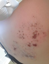 RMR-86 Instant Mold & Mildew Stain Remover Spray - 30 Fl Oz, No Scrubbing Needed 0.96 per fl oz