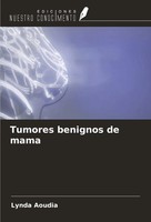 Lynda Aoudia | Tumores Benignos De Mama | Taschenbuch | Spanisch (2024)