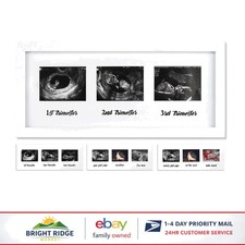 Keepsake Frame for Displaying Pregnancy Ultrasound Photos, Horizontal Style