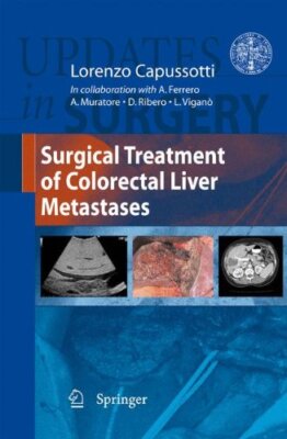Surgical Treatment of Colorectal Liver Metastas, Capussotti, Ferrero, Murato-,