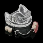 <!--F#f_0-->Dental Typodont Restoration Model Clear With 2 Implants Partial Denture Demo<!--F/-->