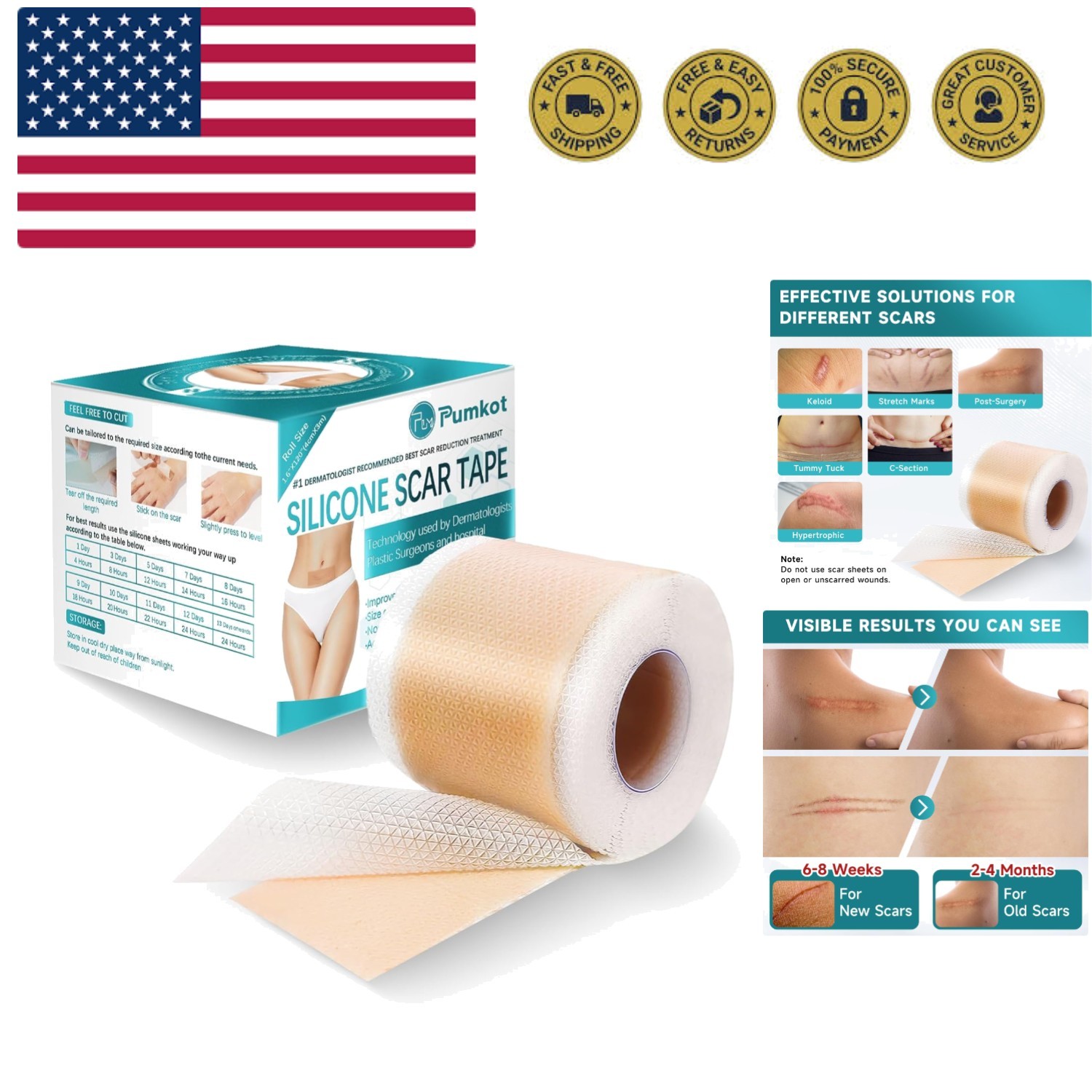 Silicone Scar Sheets, Silicone Scar Tape1.6” x 120” Roll-3M, Scar Removal Awa...