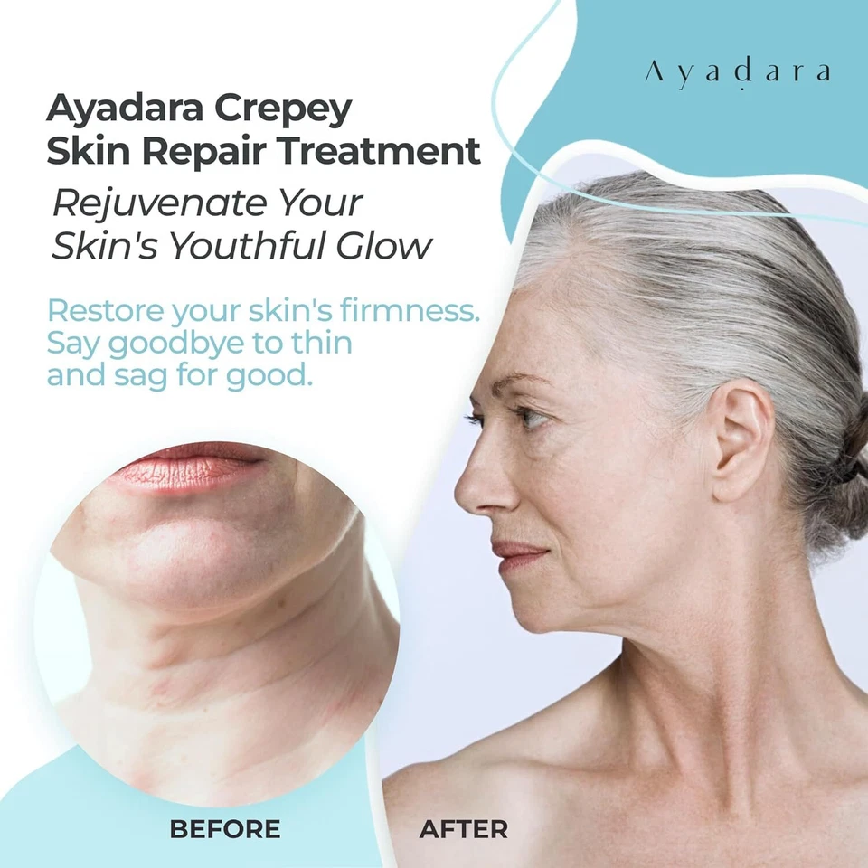 Ayadara Crepe Skin Repair Treatment, Aging & Wrinkle Lotion with Hyaluronic Acid - Image 2 of 4