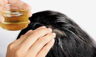 Seborrheic Dematitis Healing Oil Scalp Relief-Eczema-Psoriasis  2 oz