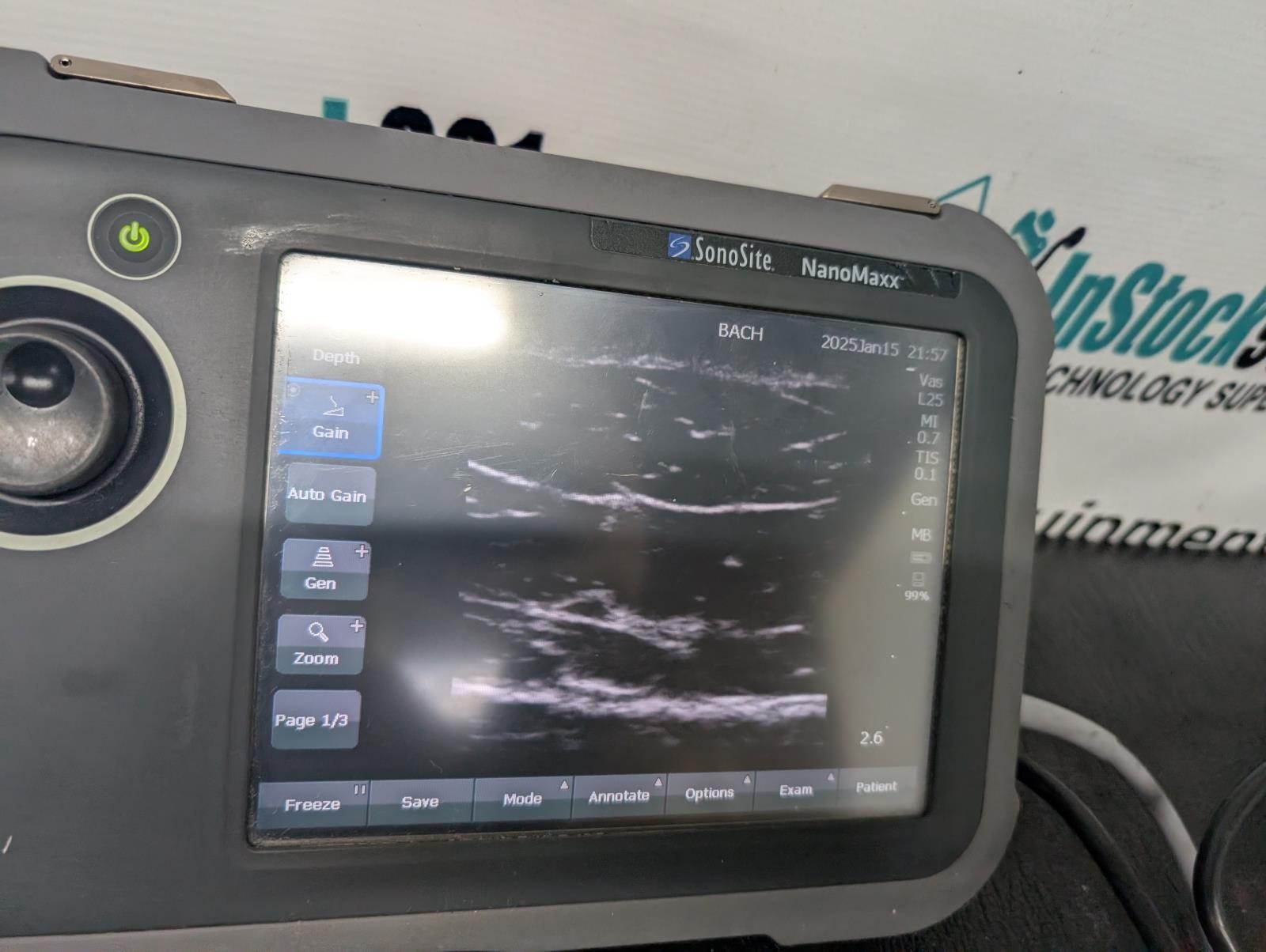 SonoSite NanoMaxx Portable Ultrasound Machine w/ L25, P21 Probes & Power Supply