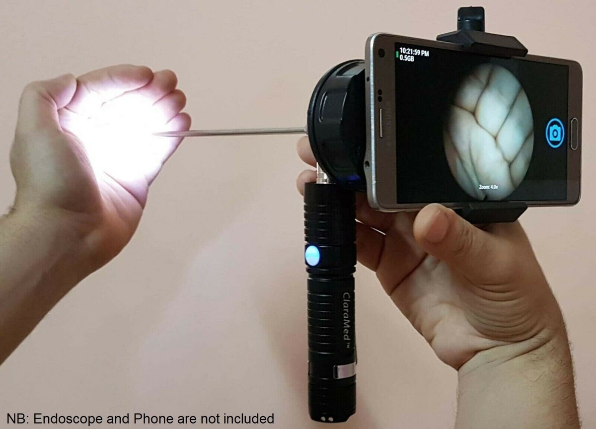 ClaraMed phone endoscope adapter with LED light source, Storz
