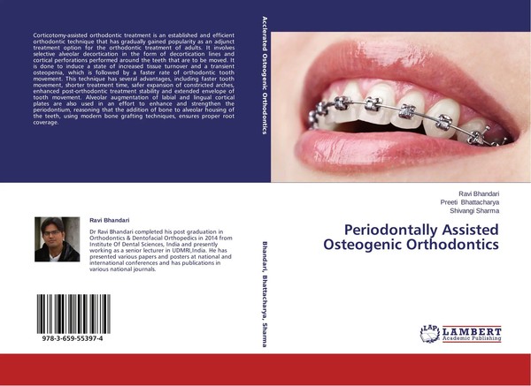 Ravi Bhandari (U. A.) | Periodontally Assisted Osteogenic Orthodontics | Buch-image