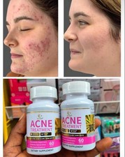 Acne Treatment Pills for Acne Treatment. Made with Organic Natural Ingredients.