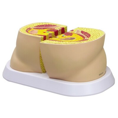 #ad #ad Obesity Body Fat GPI Anatomy Model w Key LFA #3600 Make Us an Offer SEE VIDEO $103.85