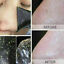 thumbnail 7  - 50pcs Nose Pore Strips Blackhead Removal Unclog Pores Smooth Deep Cleansing NEW