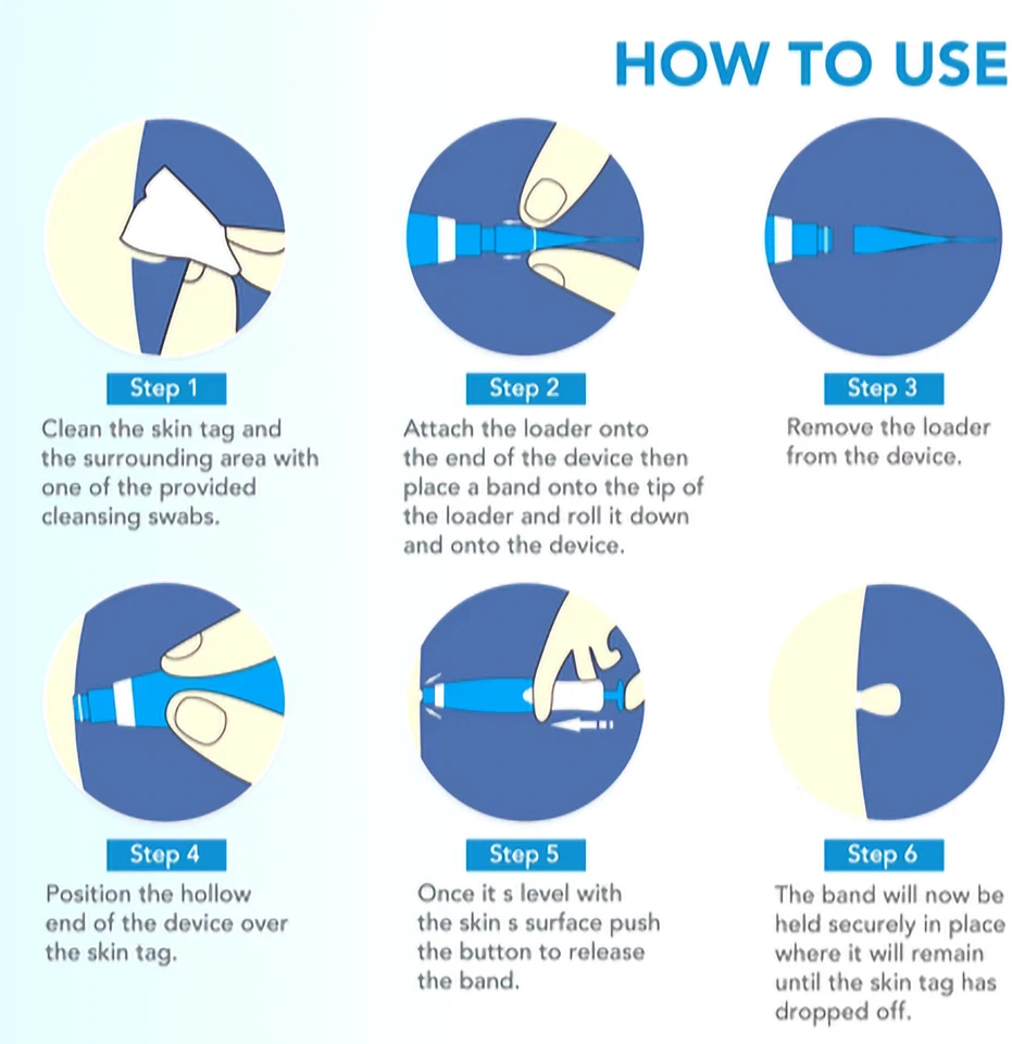 HOT Micro Skin Tag Removal Kit Mole Wart Remover Face Care Beauty Tools Painless - Image 3 of 4