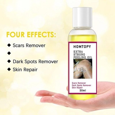 Extra starkes Peelingöl, Peeling gelbes Öl für dunkle Peeling Haut  UK