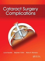 Lucio Buratto (U. A.) | Cataract Surgery Complications | Buch | Englisch (2012)