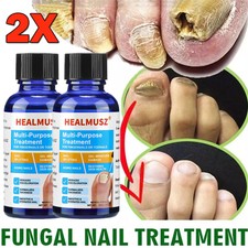 2 Pack Anti Fungal Nail Treatment Toenail Fungus Fungi Nail Repair Foot Care