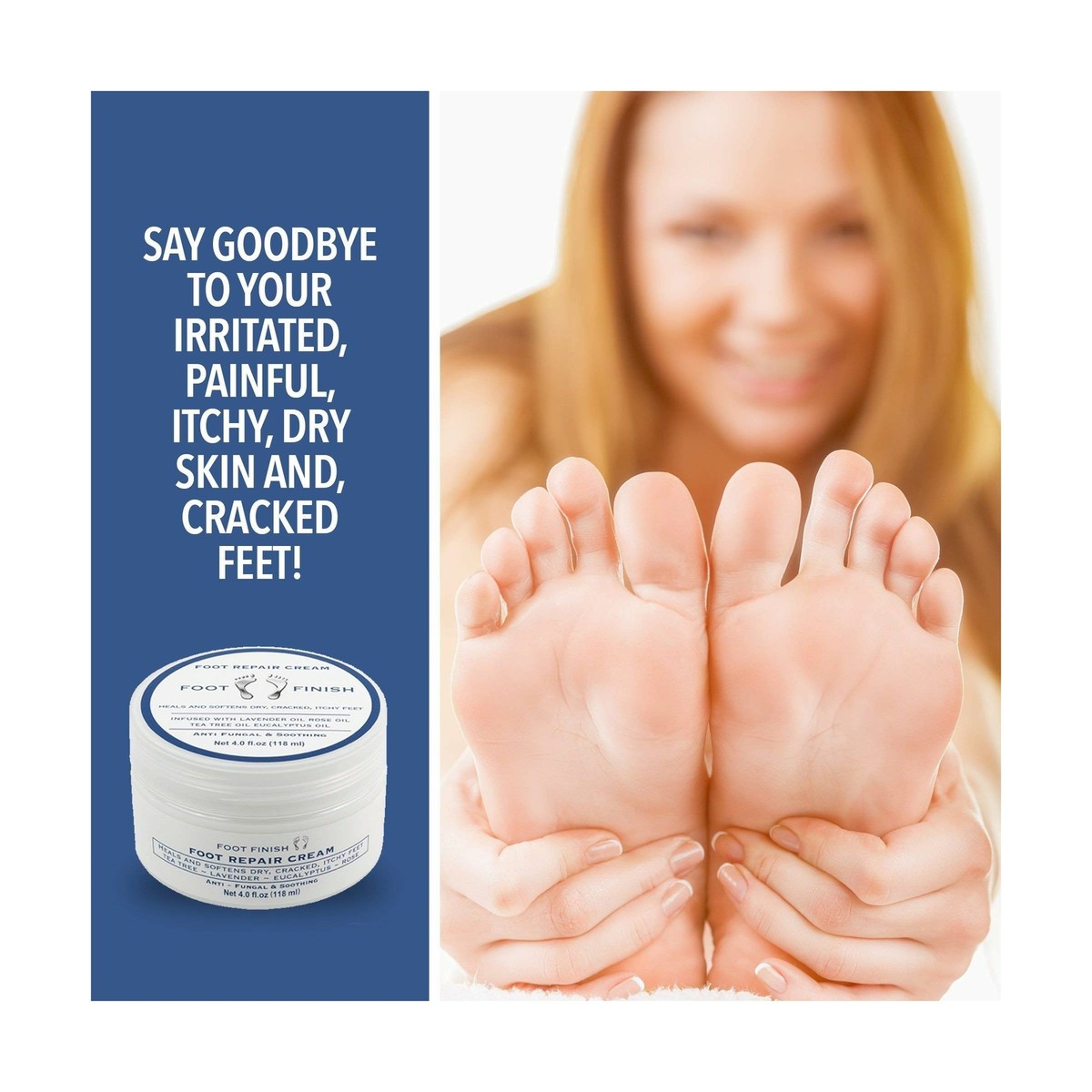 Update more than 150 black cracked heels esthdonghoadian