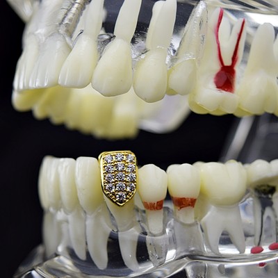 18K Gold Plated Single Cap Grillz CZ Slug Micro Pave Bling Bottom Canine Tooth