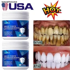 Teeth Whitening Powder Tea Coffee Smoking Stain Remover Tooth Deep Cleaning 50g