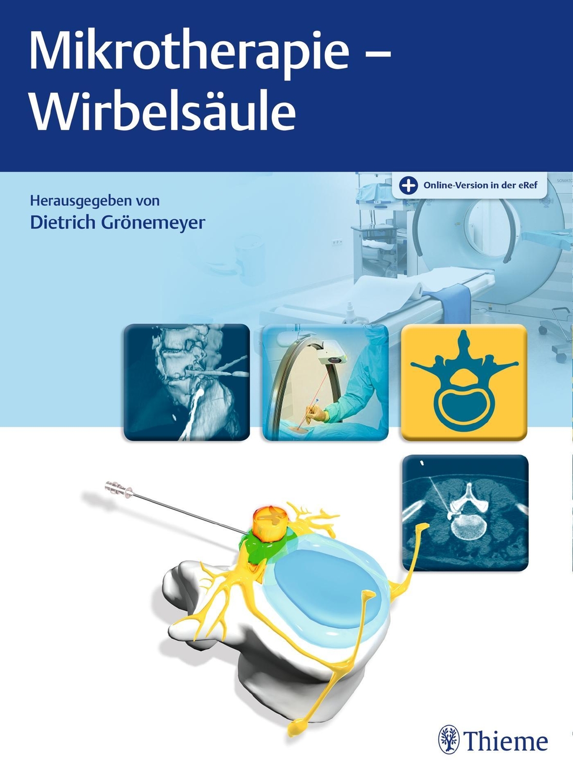 Thumbnail - Mikrotherapie - Wirbelsäule, Dietrich H. W. Grönemeyer